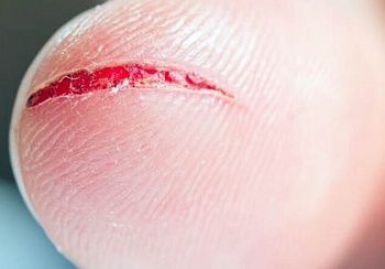 Кровоточащий пластик: Ранимый материал